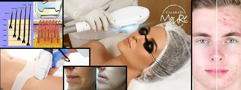 LASER DEPILACION Y TRATAMIENTOS MALLORCA CENTRO DE ESTETICA MOURE