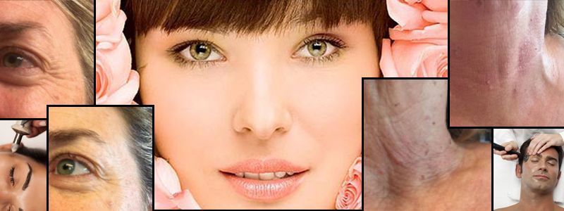 OFERTA DE ESTETICA EN PALMA DE MALLORCA DE ÁCIDO HIALURÓNICO MALLORCA POR 59€