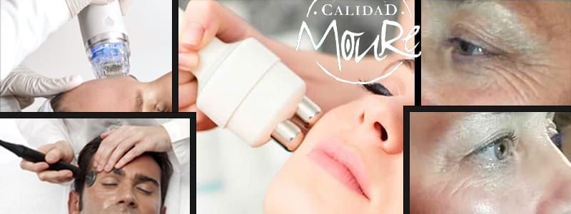OFERTA DE ESTETICA RADIOFRECUENCIA FACIAL PALMA DE MALLORCA