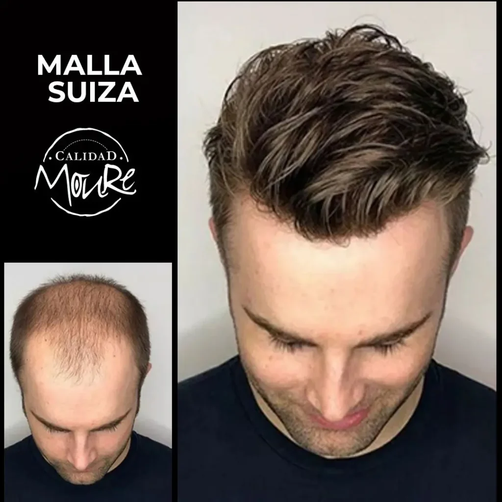 PROTESIS CABALLERO MOURE MALLA SUIZA (9)