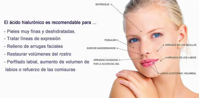 Ácido-hialurónico en que se recomienda Moure