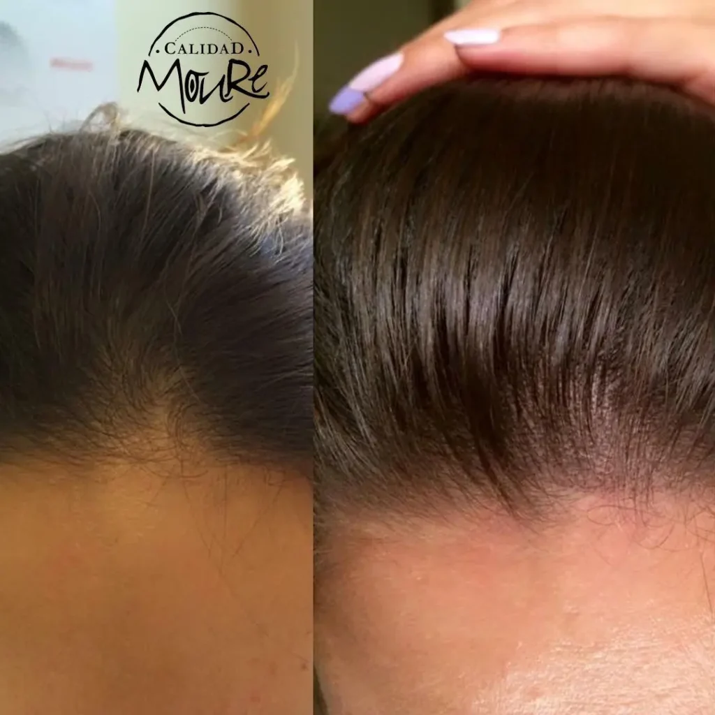 MICROPIGMENTACION MUJER MOURE MAS DENSIDAD PELO LARGO (13)
