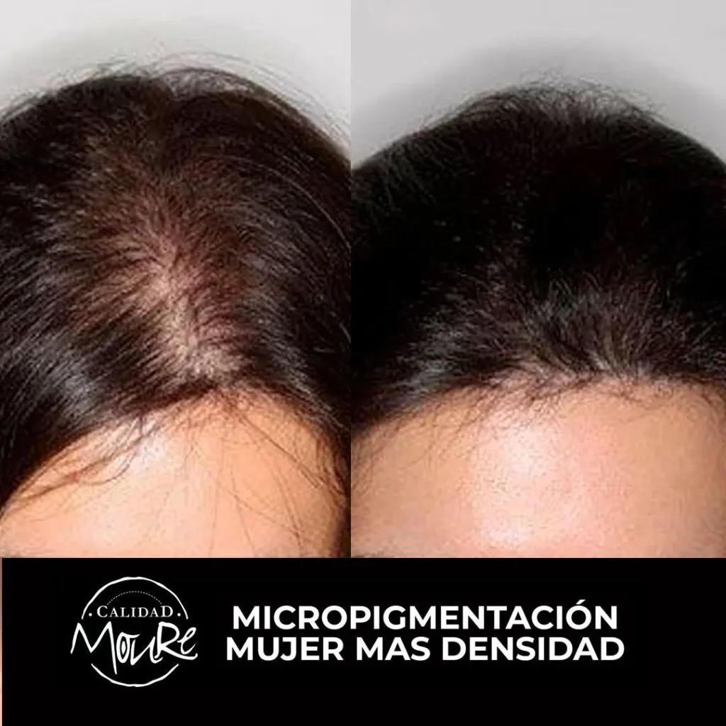 MICROPIGMENTACION MUJER MOURE MAS DENSIDAD PELO LARGO (18)