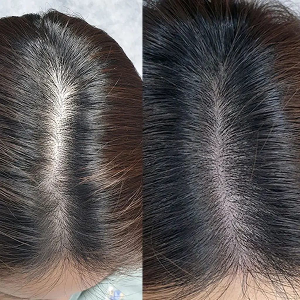 MICROPIGMENTACION MUJER MOURE MAS DENSIDAD PELO LARGO (2)