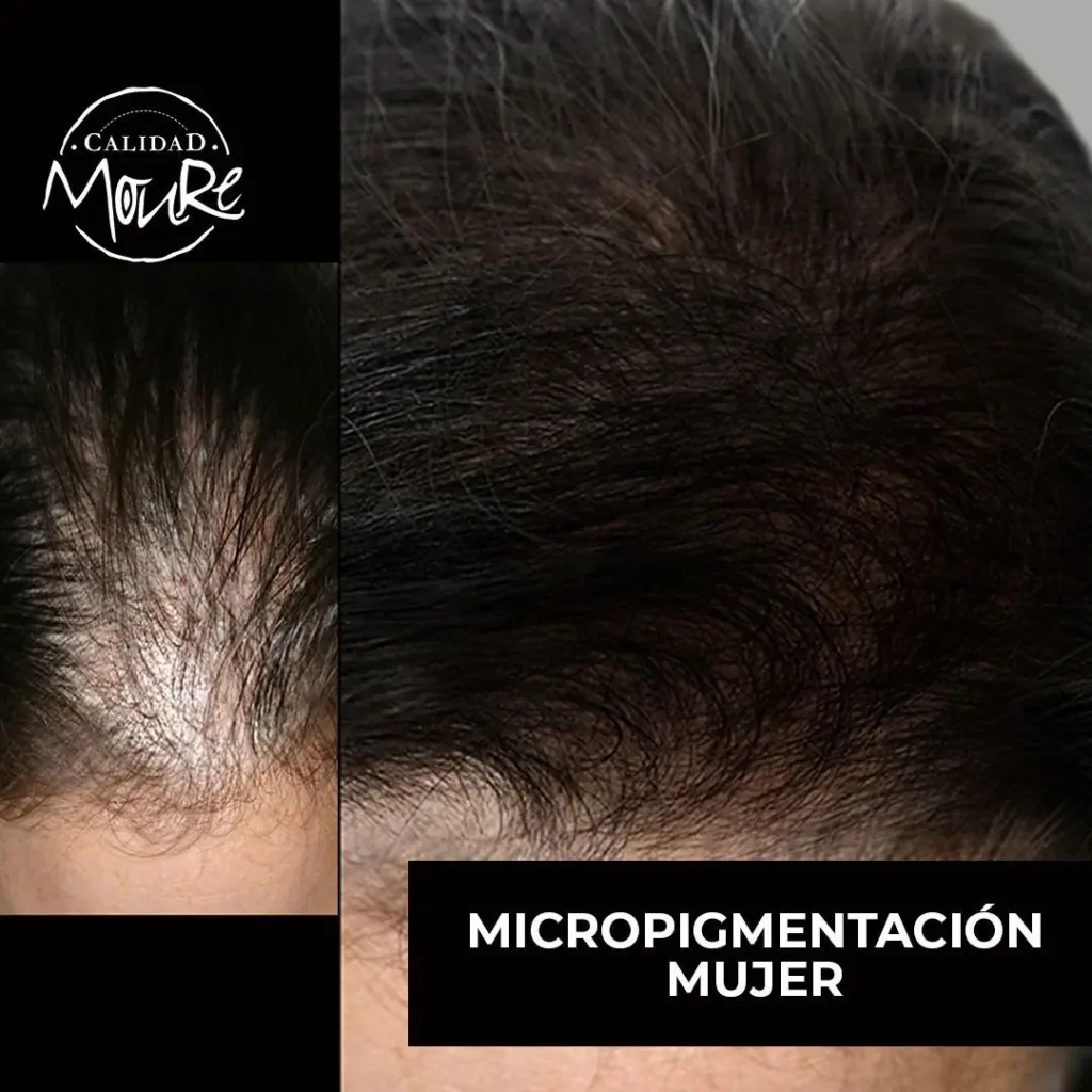 MICROPIGMENTACION MUJER MOURE MAS DENSIDAD PELO LARGO (8)
