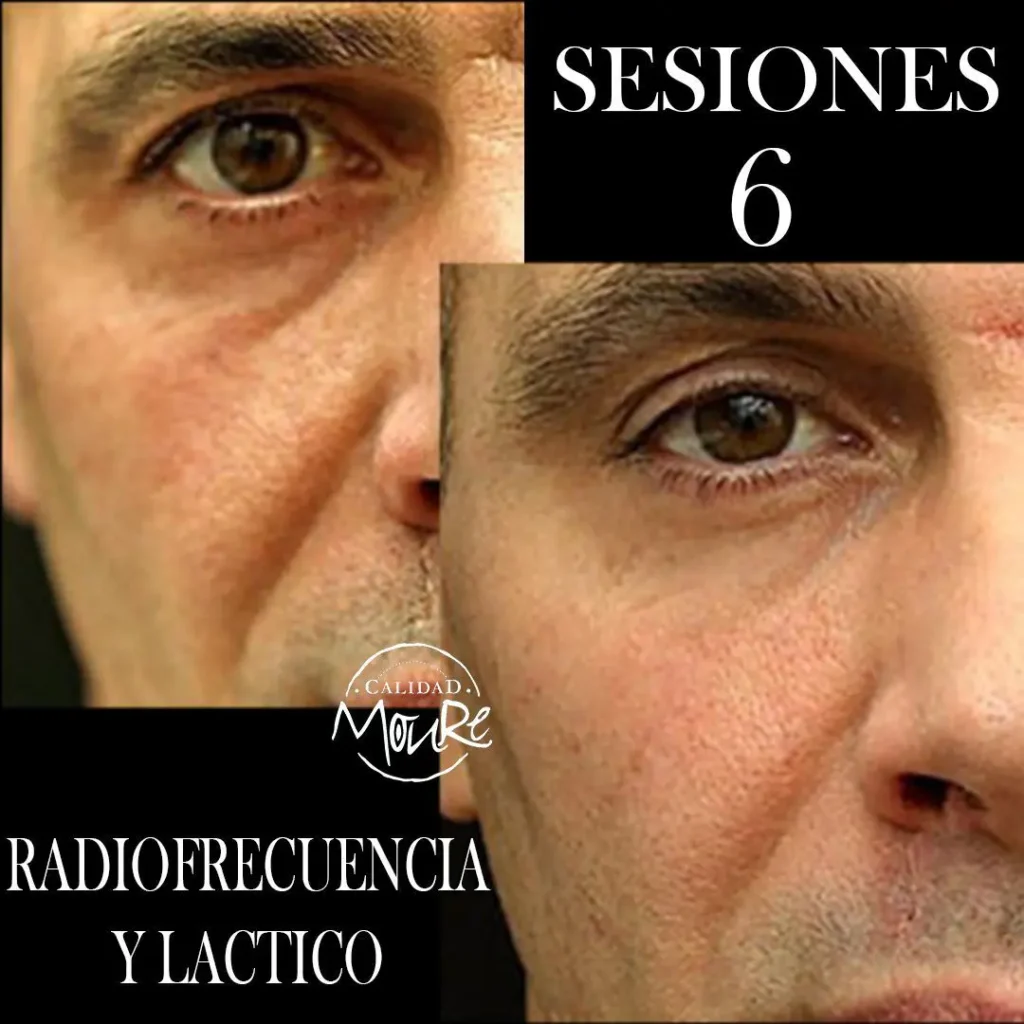 RADIOFRECUENCIA LASER GALVANICA Y ACIDO HIALURONICO CENTRO DE ESTETICA MOURE MALLORCA (11)