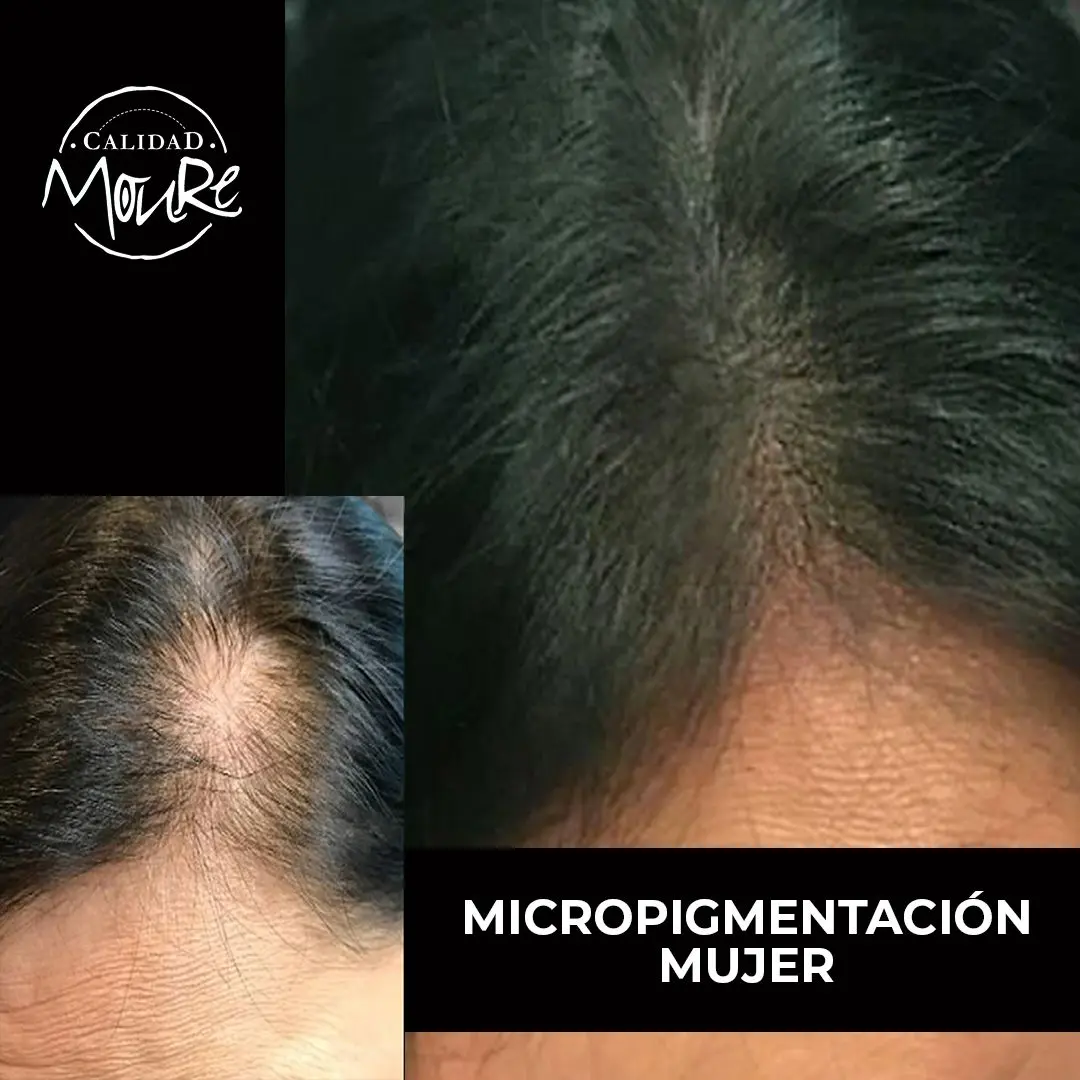 MICROPIGMENTACION MUJER MOURE MAS DENSIDAD PELO LARGO